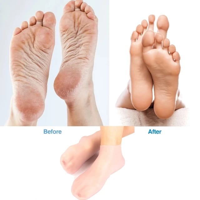 Silicone Moisturizing Gel Socks